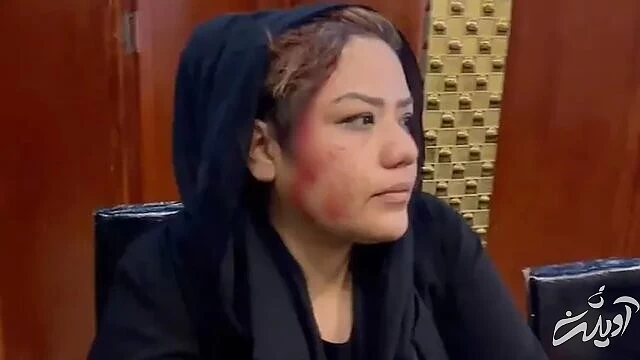 حمله طالبان به اعتراضات زنان در کابل/عکس